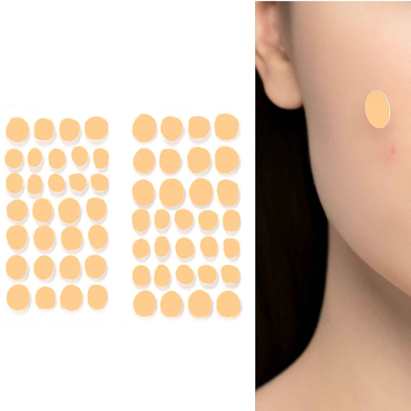 Pimple Patches for Face (2 Sheet Set)
