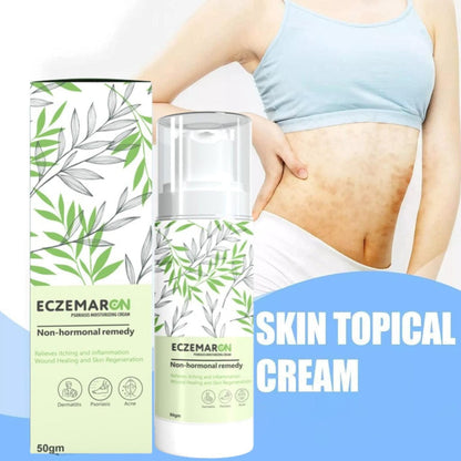 Eczemaron Cream (BUY 1 Get 1 FREE)